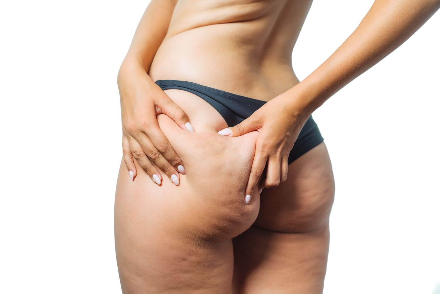 Tecarterapia per cellulite: come funziona